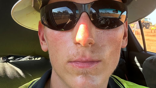 TV 2 Echo skrev om mit liv i Australien – her er hvorfor